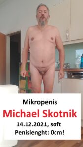 Mikropenis Michael Skotnik soft