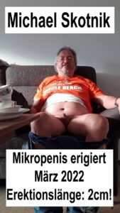 Mikropenis Michael Skotniks Erection