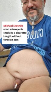Mikropenis of Michael Skotnik smoking