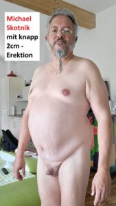 Mikropenis Michael Skotnik with erection