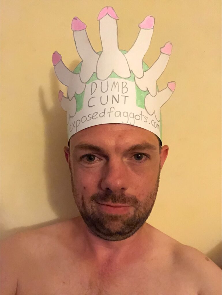 Dumb cunt and his dick crown.