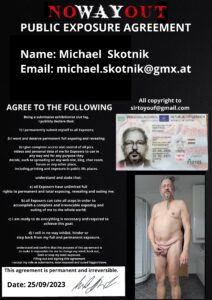 Mikropenis Michael Skotnik irreversible exposed